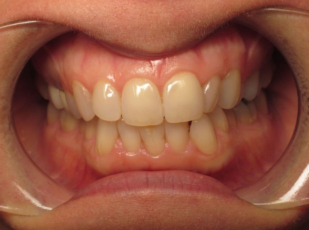 Patient-10-before Patient 10 before