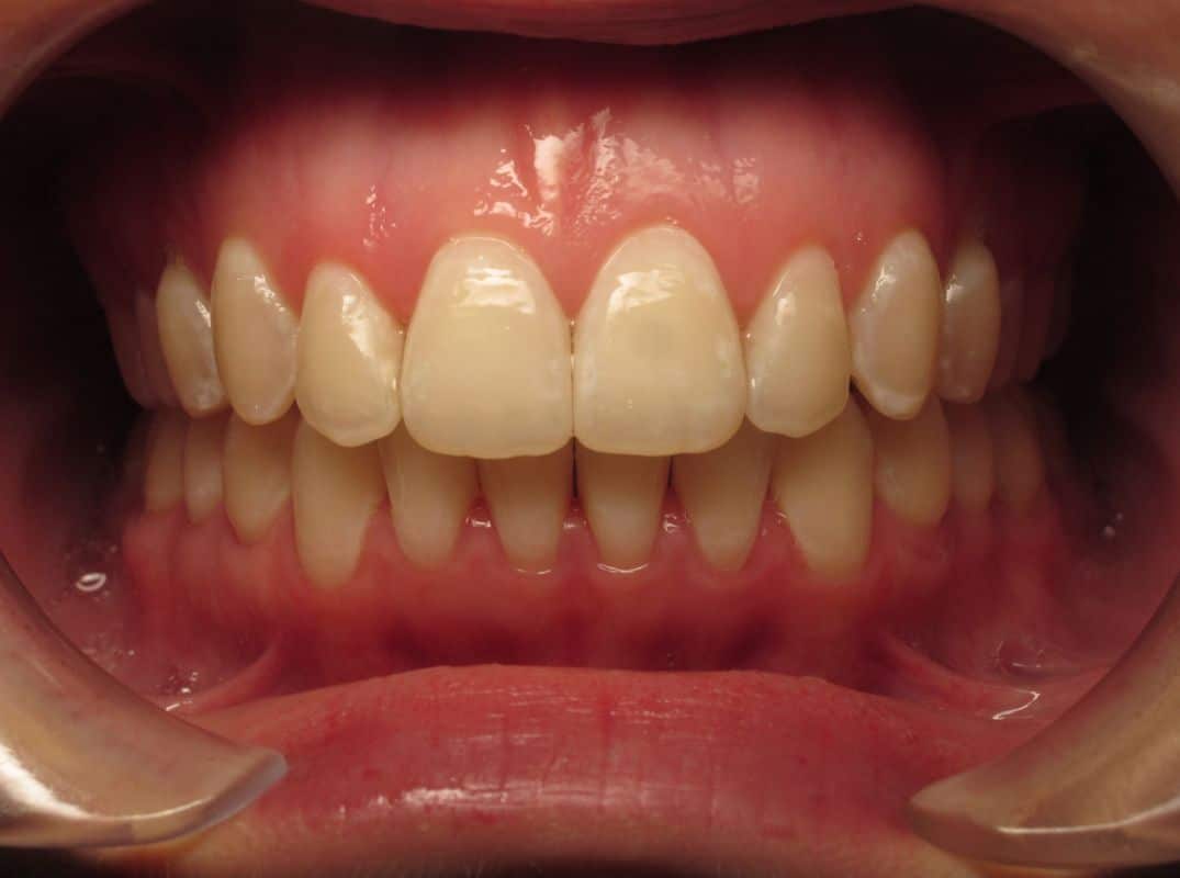 Patient-15-after Patient 15 after