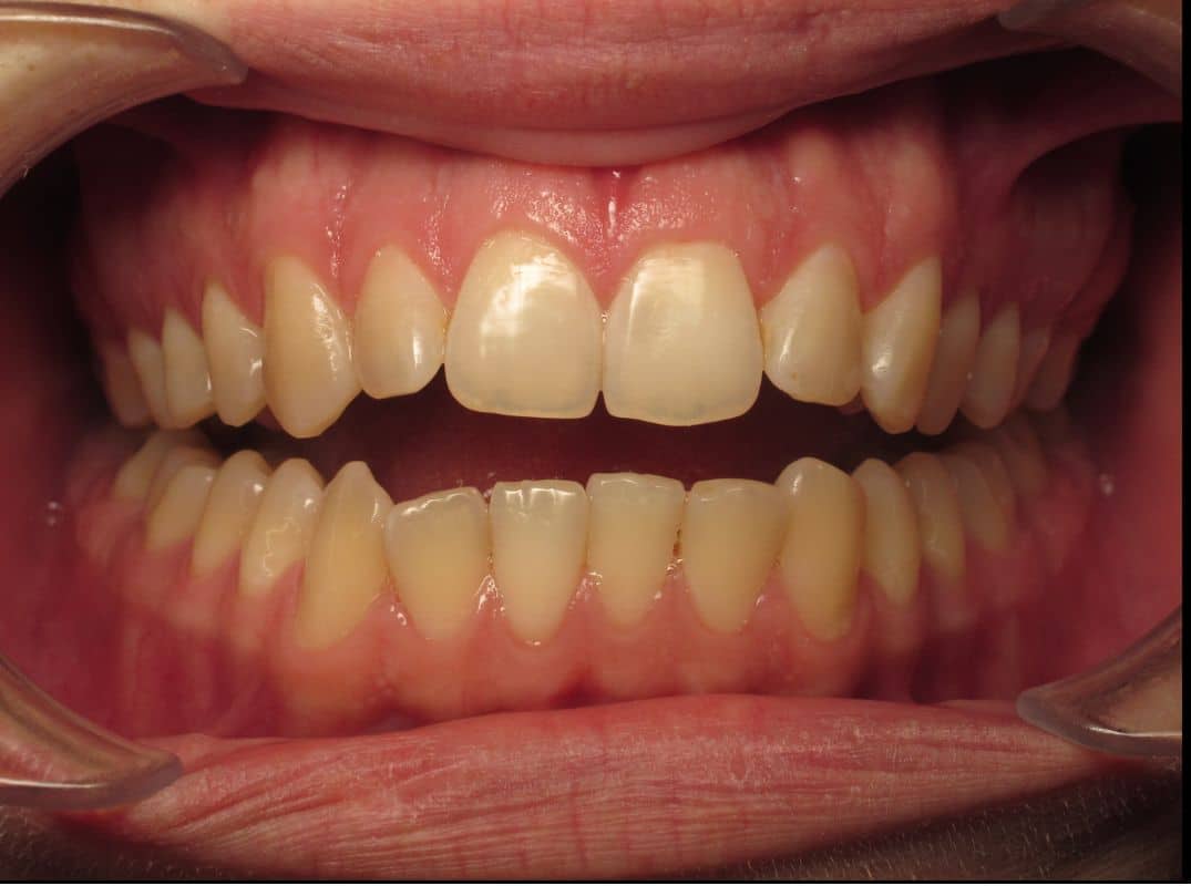 Patient-4-before Patient 4 before