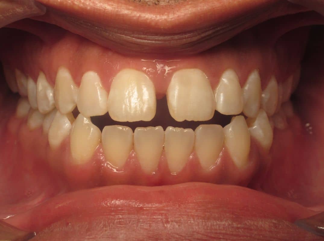 Patient-5-before Patient 5 before