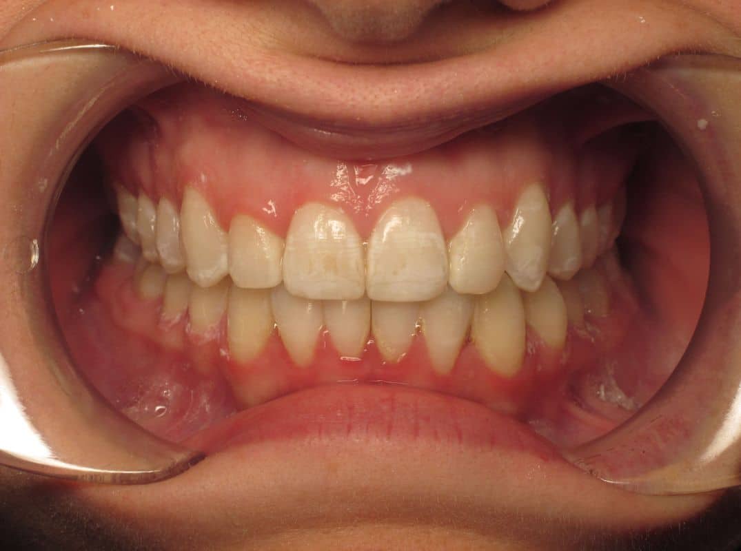 Patient-7-after Patient 7 after