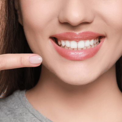 Effective oral health solutions and orthdontics 3 Woman pointing at her white teeth, smiling, representing oral health