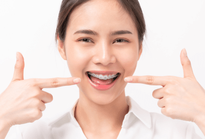 Traditional braces: pros and cons 12 Young woman smiling and pointing toward her traditional braces